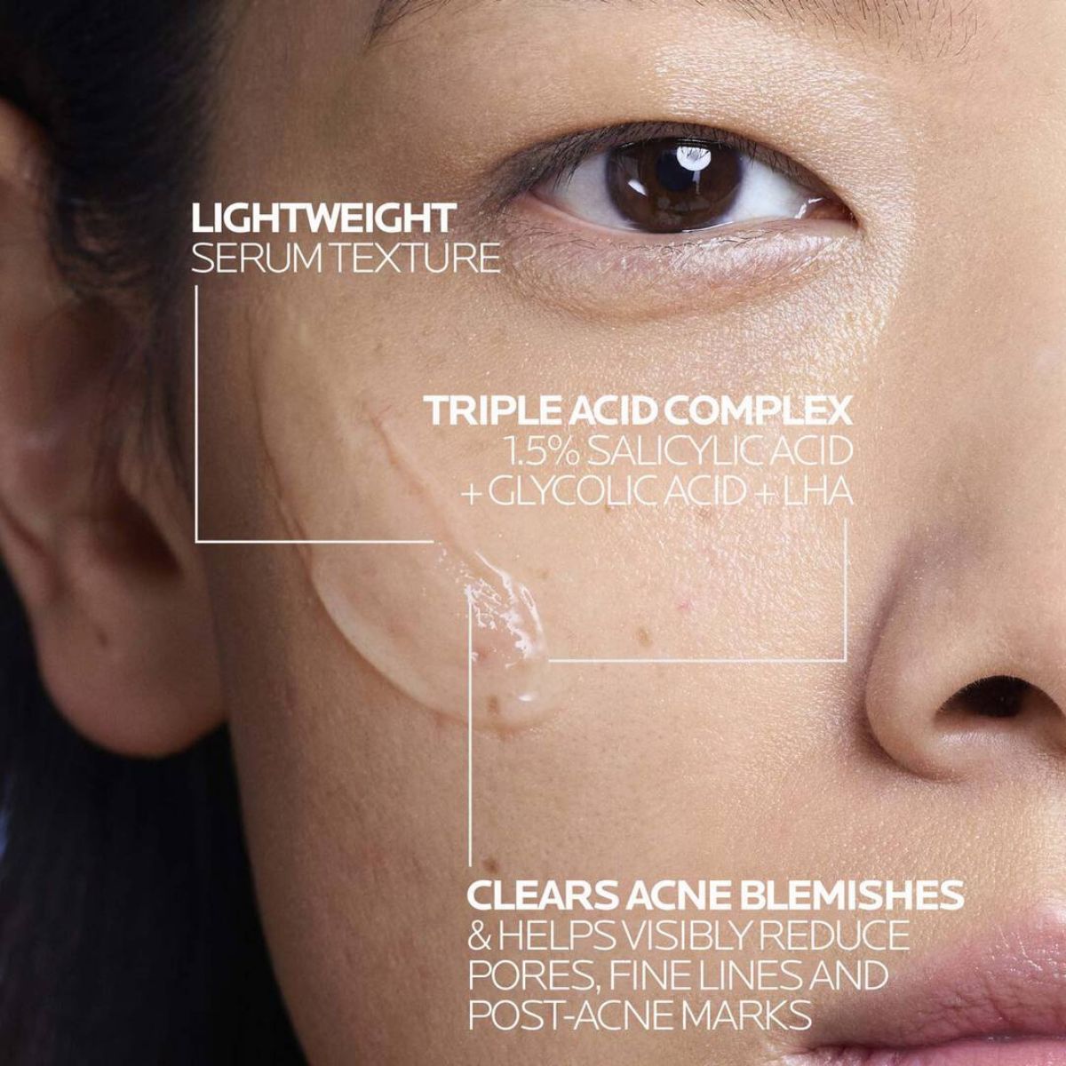 La Roche-Posay Effaclar Ultra Concentrated Anti-Imperfections Serum 30ml
