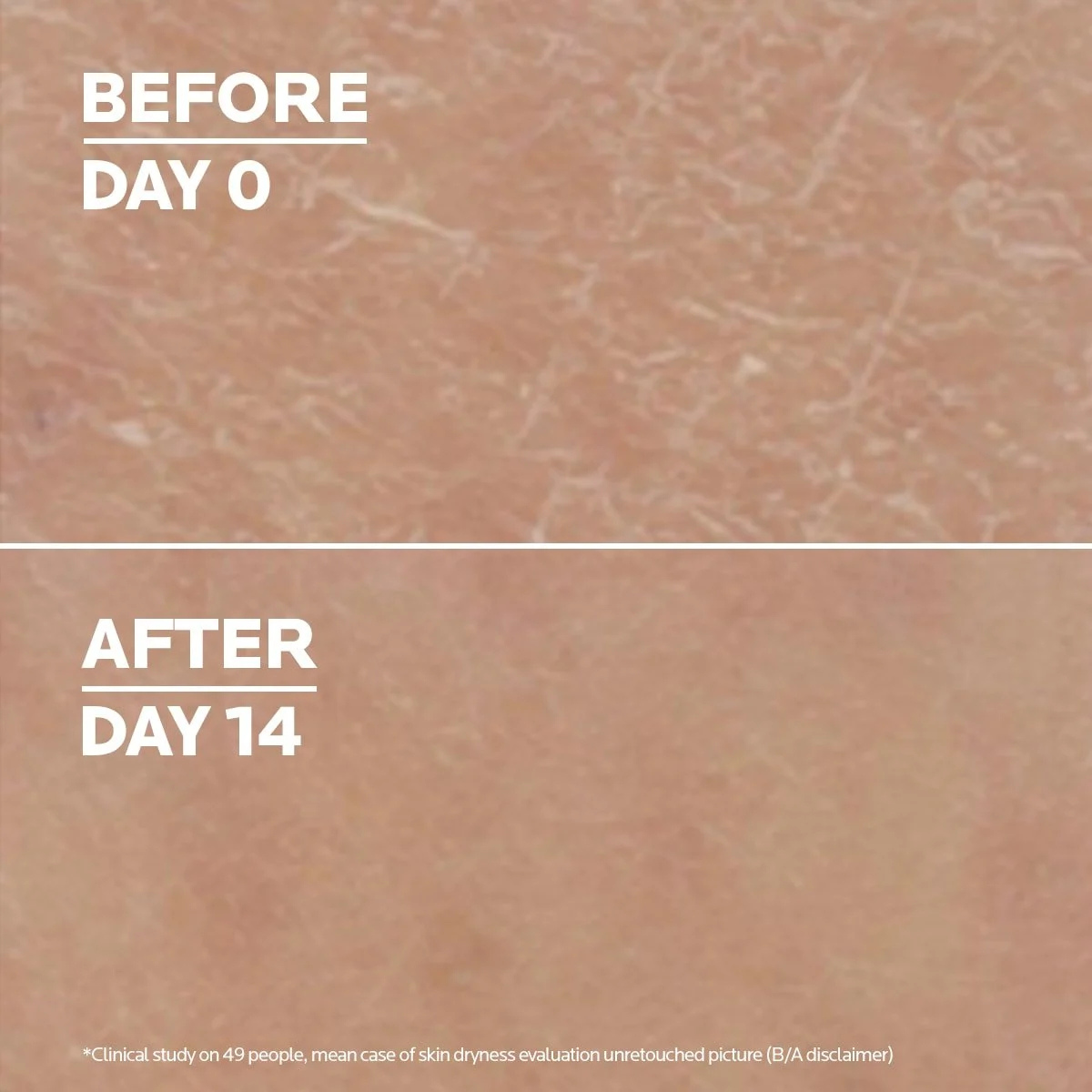 La Roche-Posay Lipikar Lait Urea 10% Body Milk results
