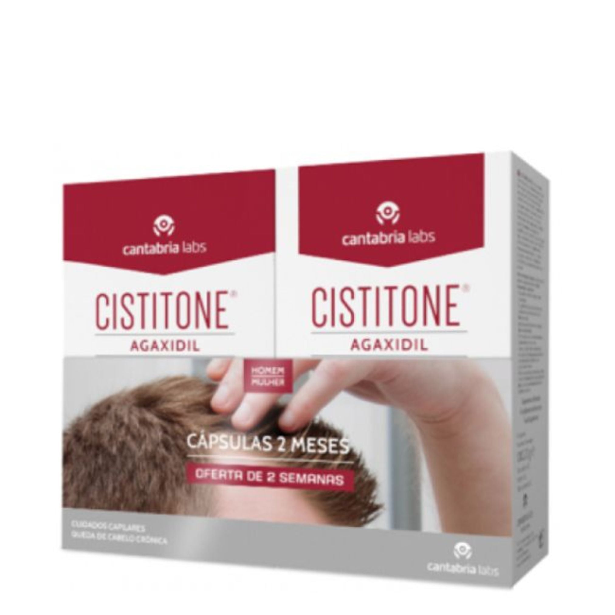 Cistitone Agaxidil Chronic Hair Loss Capsules X60 +14